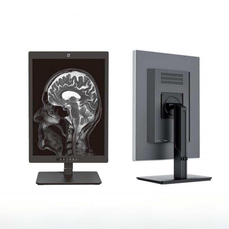 Monitor de diagnóstico médico de 20,1 pulgadas y 2 MP