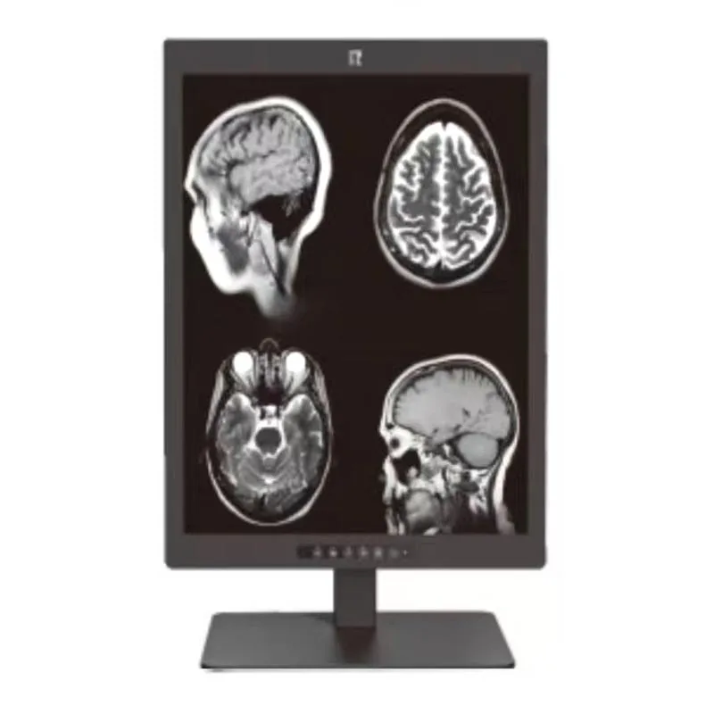 Pantalla de diagnóstico médico de 21,3 pulgadas y 3 MP