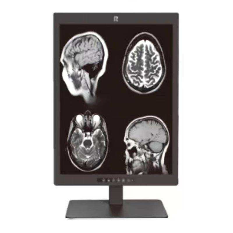 Monitor de diagnóstico médico de 21,3 pulgadas y 3MP