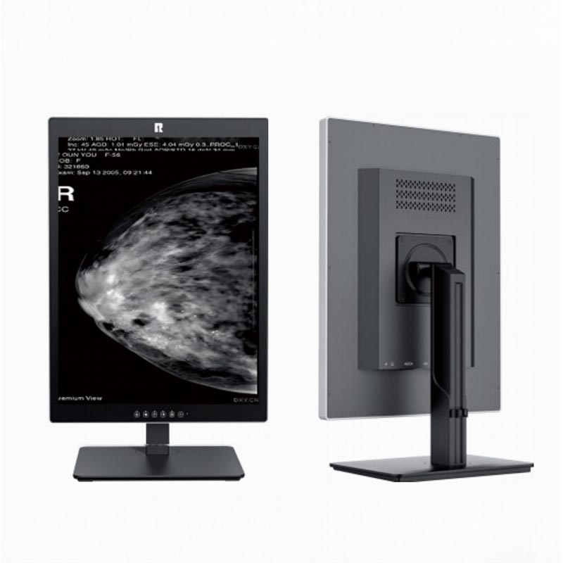 Monitor de diagnóstico médico de 21,3 pulgadas y 5 MP