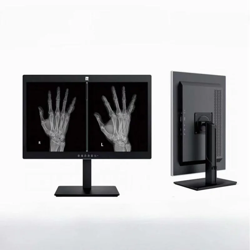 Pantalla de diagnóstico médico de 24 pulgadas y 2 MP