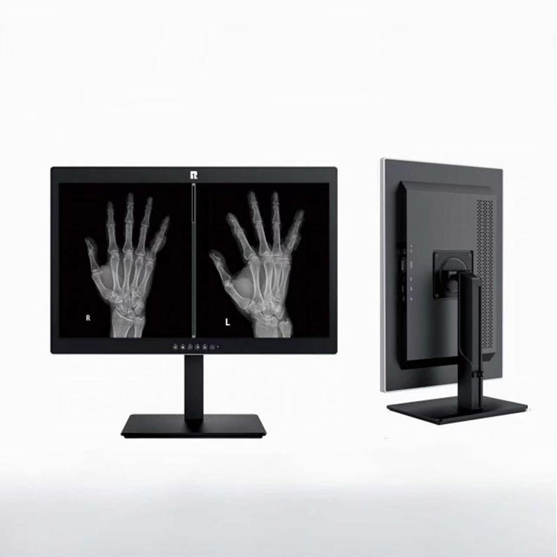 Monitor de diagnóstico médico de 24 pulgadas y 2MP