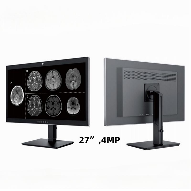 Pantalla de diagnóstico médico de 27 pulgadas y 4MP