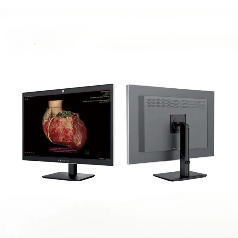Monitor de diagnóstico médico de 30 pulgadas y 6 MP