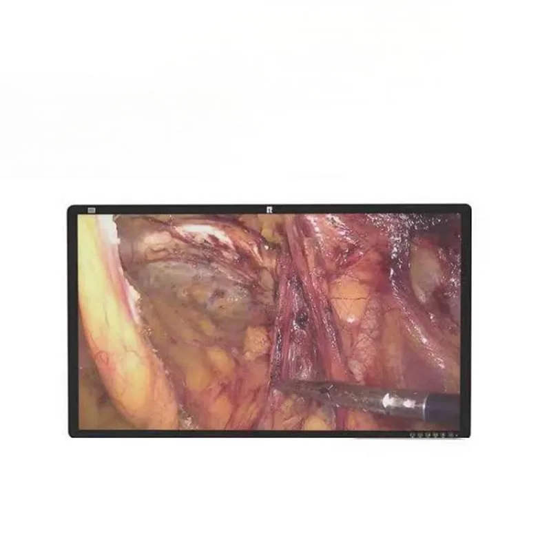 Monitor médico quirúrgico 4K de 32 pulgadas