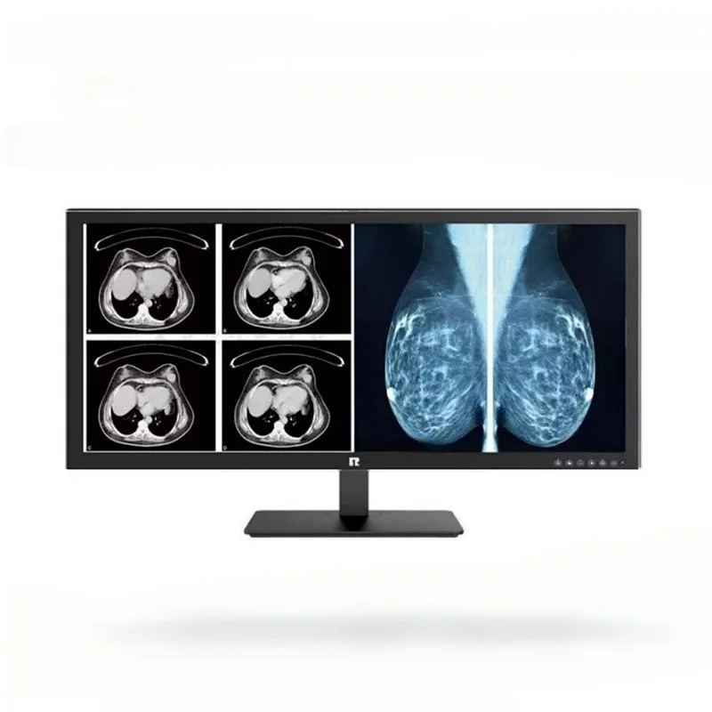 Monitor de diagnóstico médico de 34 pulgadas y 5MP