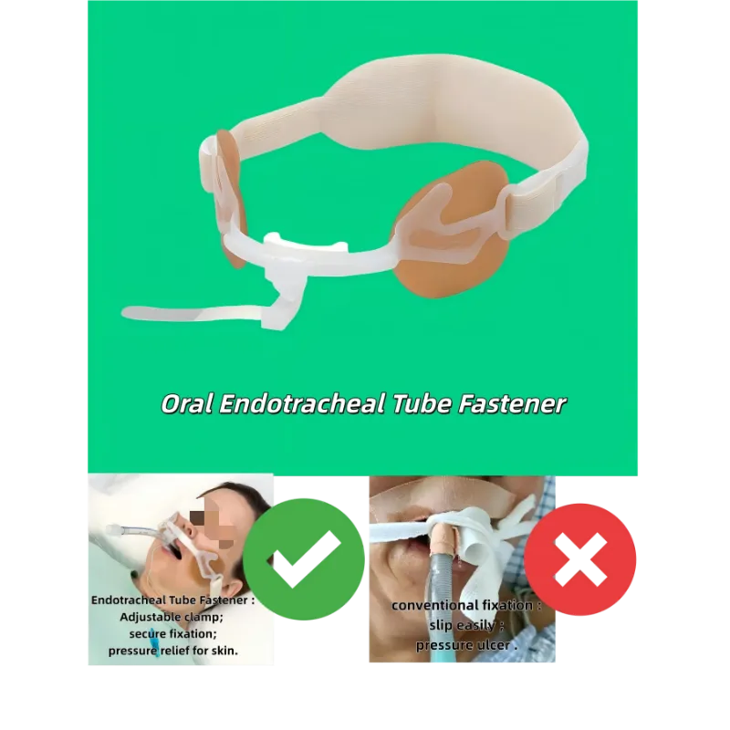 Sujetador de tubo endotraqueal